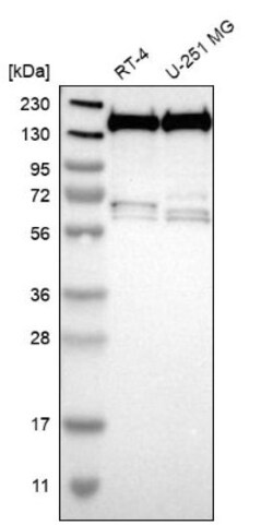 THRAP3 Antibody, Novus Biologicals 0.1 mL | Buy Online | Novus Biologicals | Fisher Scientific